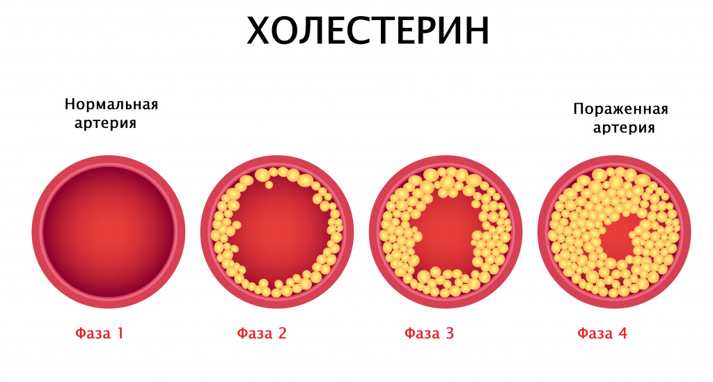 снижение вредного холестерина с поиощью масла криля